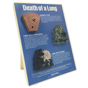 HEALTH EDCO 喫煙の影響 人体模型セット Smoking Health Consequences 3-D Display | Health Edco