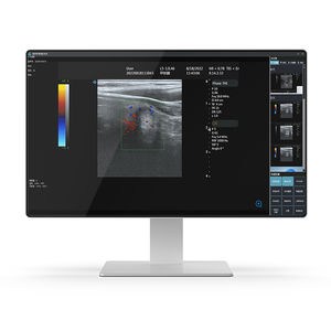 Intel® Core i7医療用PC