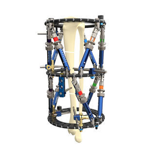 脛骨用外部固定システム
