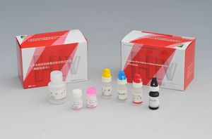 AIDS用迅速検査キット