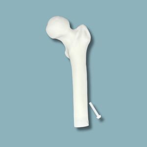 大腿骨の解剖模型