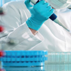 ヘルペス検査キット