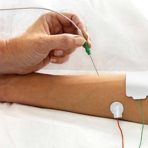 EMG電極