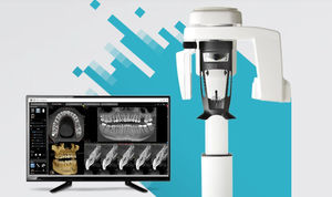 歯科用CTスキャナー