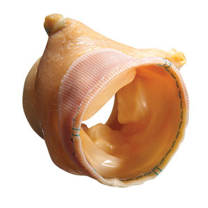 大動脈生体弁