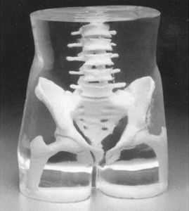 X線撮影用試験用ファントム