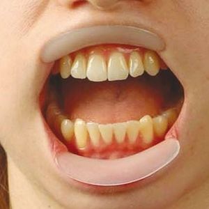 口腔用レトラクタ