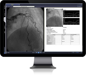 医用画像用PACS（画像保管通信システム）