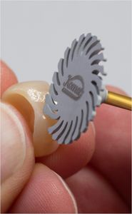 歯科技工所用バー 1