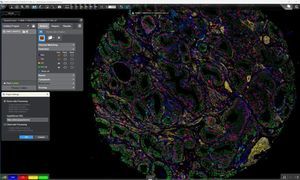 病院用AIプラットフォーム 1