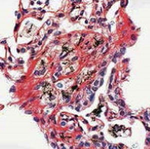 染色液試薬 1
