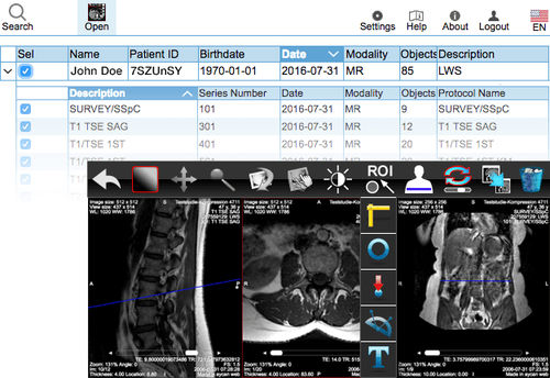 共有ウェブアプリケーション - aycan Medical Systems - DICOMビジュアリゼーション用 / 医用画像用 / ウェブ上
