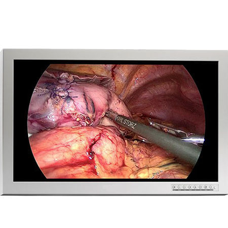 外科用モニター - C27SF - Double Black Imaging - フルHD / 27インチ / LED