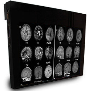 医療用モニター - DBI24 - Double Black Imaging - 1920x1200 / 24インチ / LCD