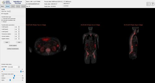 品質管理ソフト - SUV SPECT® - Hermes Medical Solutions, Inc - データ収集 / 検証用 / 診療所用