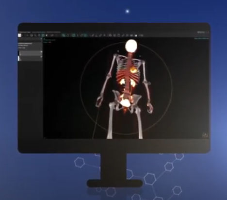 リポーティング用ソフト - vendor-neutral - Hermes Medical Solutions, Inc - 診療所用 / CT / ポジトロン断層法（PET）