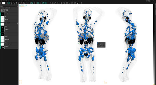 処理ソフト - Voxel dosimetry™ - Hermes Medical Solutions, Inc - 検証用 / 診療所用 / CT