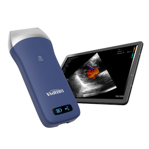 手持ち式超音波装置 - Shenzhen Viatom Technology Co., Ltd. - 多目的超音波画像診断用 / 肺エコー用 / 白黒