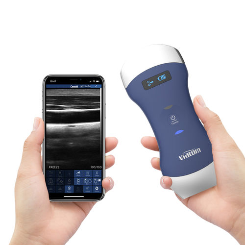 手持ち式超音波装置 - Viatom Dual Head - Shenzhen Viatom Technology Co., Ltd. - 多目的超音波画像診断用 / 白黒 / カラードップラー