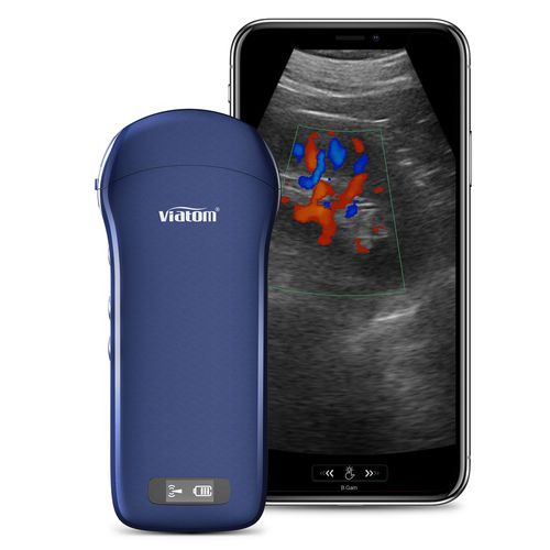 手持ち式超音波装置 - C10 - Shenzhen Viatom Technology Co., Ltd. - 多目的超音波画像診断用 / 白黒 / カラードップラー