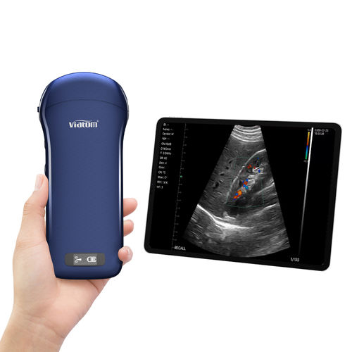 手持ち式超音波装置 - C10   - Shenzhen Viatom Technology Co., Ltd. - 多目的超音波画像診断用 / 白黒 / カラードップラー