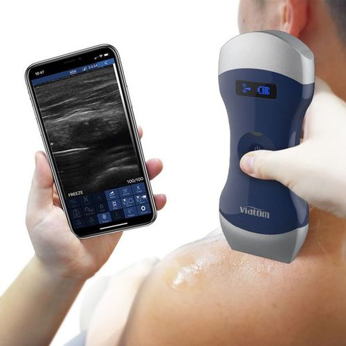 手持ち式超音波装置 - Uprobe-C 4PL - Shenzhen Viatom Technology Co., Ltd. - 多目的超音波画像診断用 / 白黒 / カラードップラー
