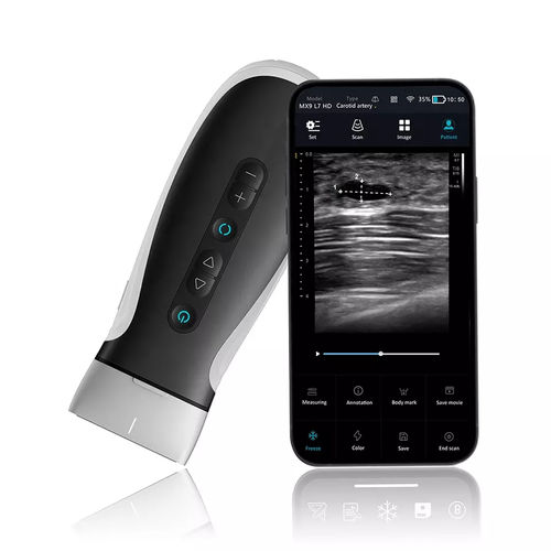手持ち式超音波装置 - MX9V - Shenzhen Viatom Technology Co., Ltd. - 多目的超音波画像診断用 / 白黒 / カラードップラー