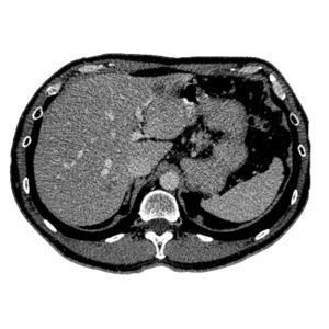 処理ソフト - MeVis Medical Solutions AG - 教育用 / 医療用 / 医用画像用