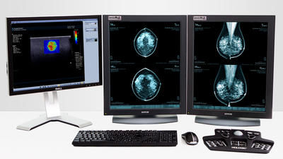 分析ソフト - MeVis Medical Solutions AG - 診断用 / 計画用 / CAD