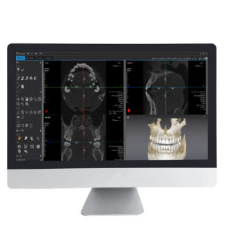 分析ソフト - Dentiq 3D - 3D Industrial Imaging, Co., Ltd. - 3D ヴィジュアリゼーション / 診断用 / 処理計画
