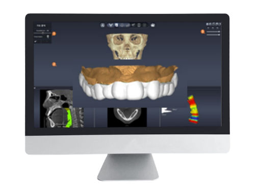 デザインソフト - DentiqAir - 3D Industrial Imaging, Co., Ltd. - 医療用 / 歯科用