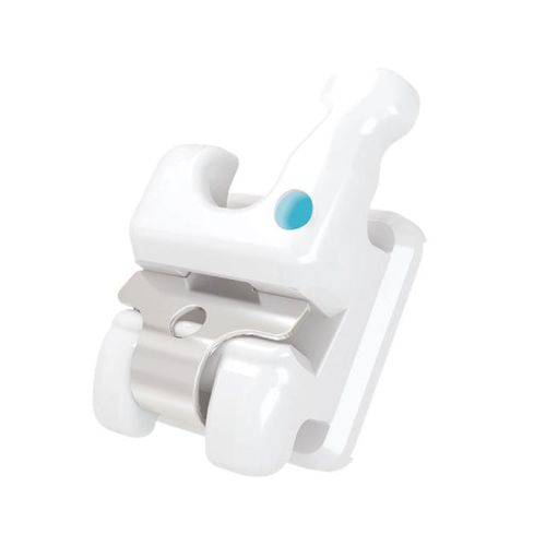 セラミック製矯正ブラケット - Thomas C - Creative Dental