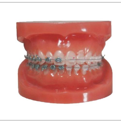 歯並び用タイポドント - Creative Dental - 歯科治療