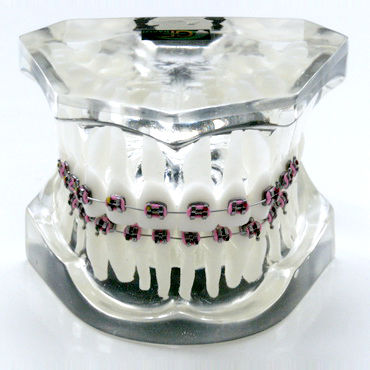 歯並び用解剖模型 - OTB1 - GF DENTAL - 歯科矯正用 / 医療訓練用 / 樹脂製