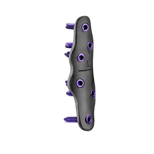 中足指節関節用関節固定プレート - CarboFix Orthopedics - ロッキング / ノンロッキング / 金属製
