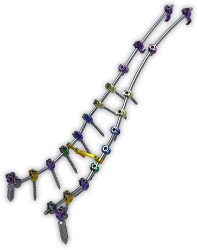 胸椎-腰椎-仙椎骨接合システム - Lancer™ - ChoiceSpine - 後方進入