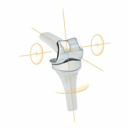 手の人工指節間関節 - PIPR™ - MatOrtho