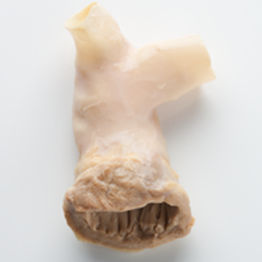 肺動脈血管バイオプロテーゼ - CryoValve® SG - Cryolife - 同種移植 / バルブ付