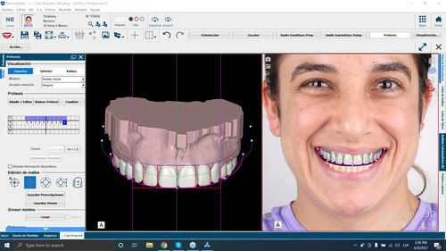笑顔デジタル設計用ソフト - NemoSmile - Nemotec - 画像強調 / イメージ分析 / 患者データ管理用