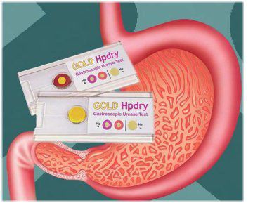 感染病用検査キット - Gold hpdry - Creo Medical - ウレアーゼ用 / ヘリコバクター ピロリ / 生物学試料用