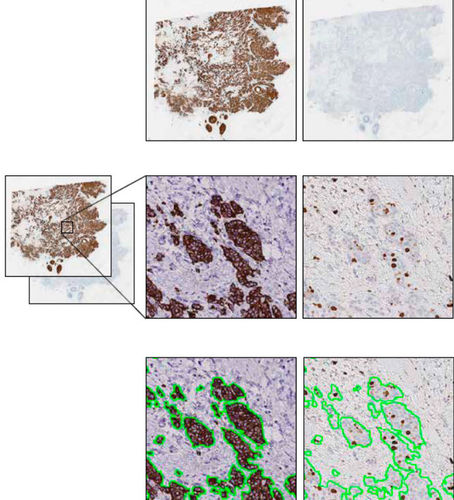 イメージ分析ソフトウェアモジュール - VirtualDoubleStaining™  - Visiopharm - 診断用 / 解析 / 診療所用
