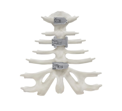胸骨用圧迫プレート - KontourTalon ® - Kontour Medical Technology - チタン製
