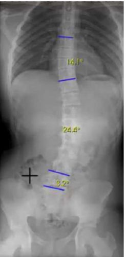 測定用ソフト - Stitching solution for column and lower limbs - Medecom - 融合 / レントゲン / 診療室用