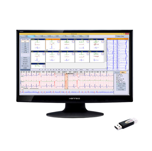 管理用ソフト - BORSAM Biomedical Instrument - 分析 / リポーティング用 / 印刷用