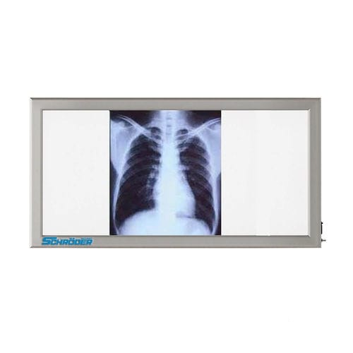 3面ネガトスコープ - NT 130 - SCHRODER HEALTH PROJECTS - 白色光