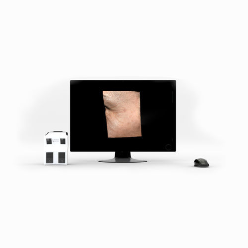 皮膚の3D画像分析システム - LifeViz® Micro - Quartier Latin