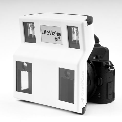 皮膚カメラ - LifeViz® Mini Pro - Quartier Latin - 3D