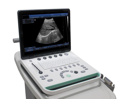 携帯型・台車付き超音波装置 - DP-50  - Promed Technology - 婦人・産科超音画像診断用 / 腹部・骨盤超音画像診断用 / 泌尿器科超音波画像診断用