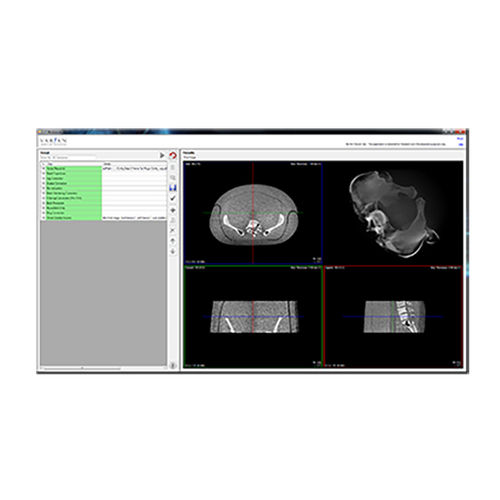 データ収集ソフト - VAREX Imaging - 画像編集 / 医療用 / レントゲン