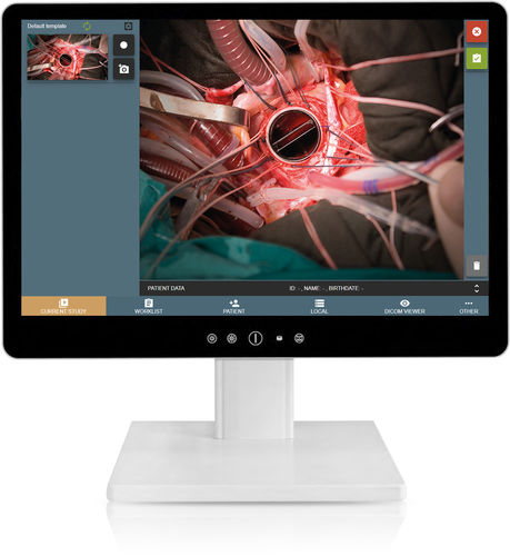 内視鏡用ビデオレコーダー - MEDDREAM VideoStation - MEDDREAM - 診断用 / 手術用 / 医療シミュレーション用